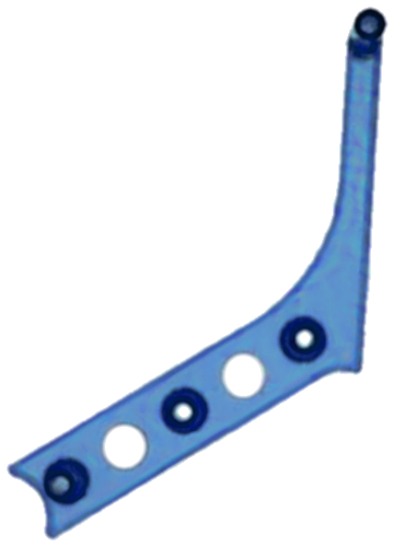 Return Lane Guide Blue - Image 1